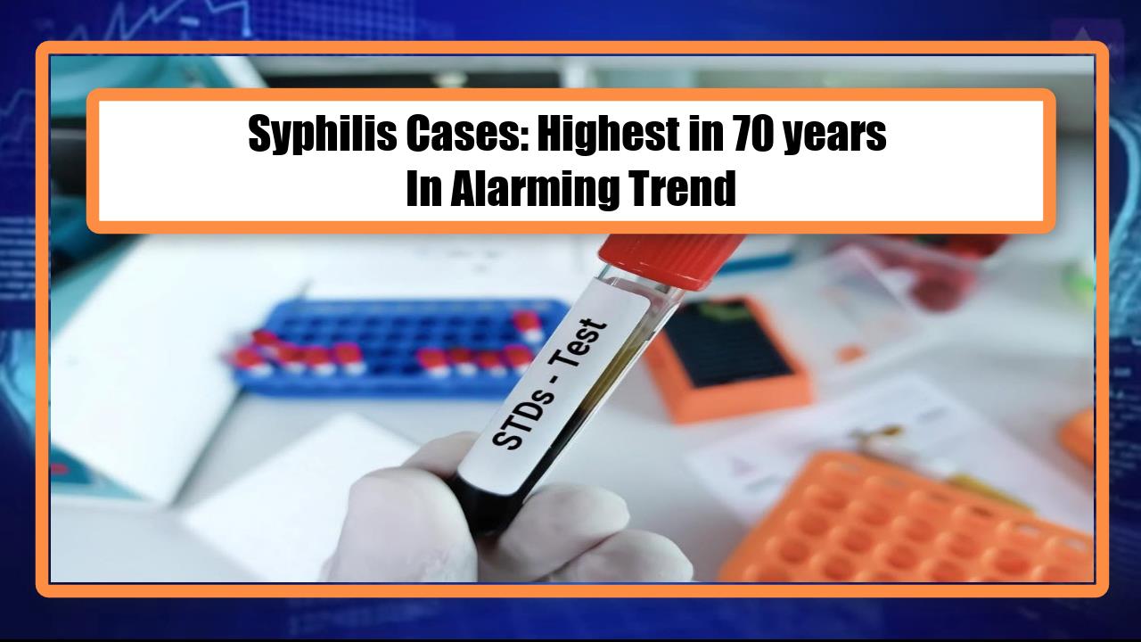 Syphilis Cases: Highest in 70 years In Alarming Trend